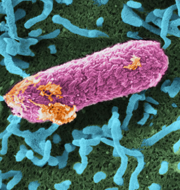 Exemplar de E. coli O157, aqui revelado por microscopia eletrônica de varredura.