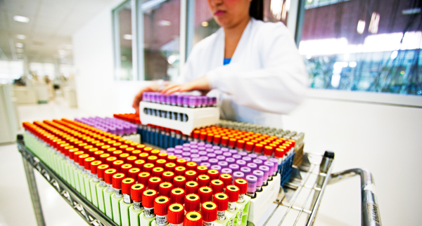 Contribuição da PCR em tempo real para diagnosticar a reativação dos herpes-vírus em imunossuprimidos